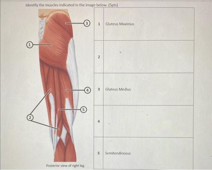 Identify the muscles indicated in figure 23.7