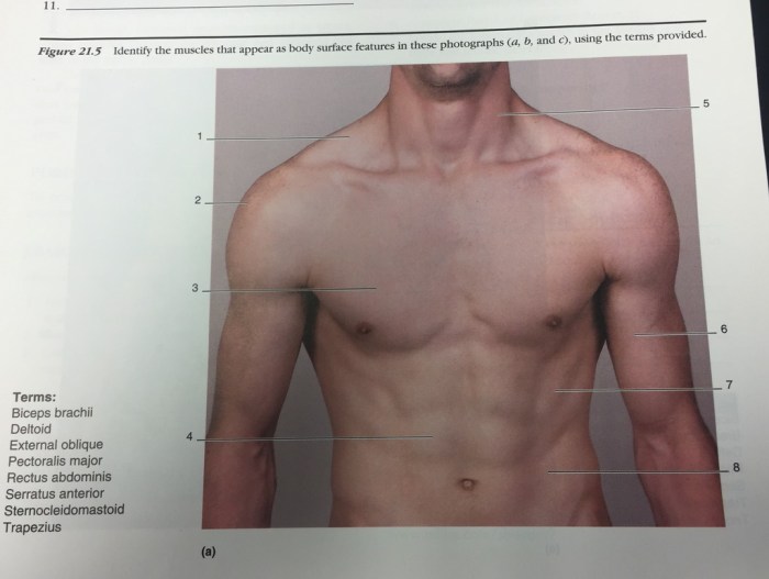 Forearm cadaver indicated chegg physiology