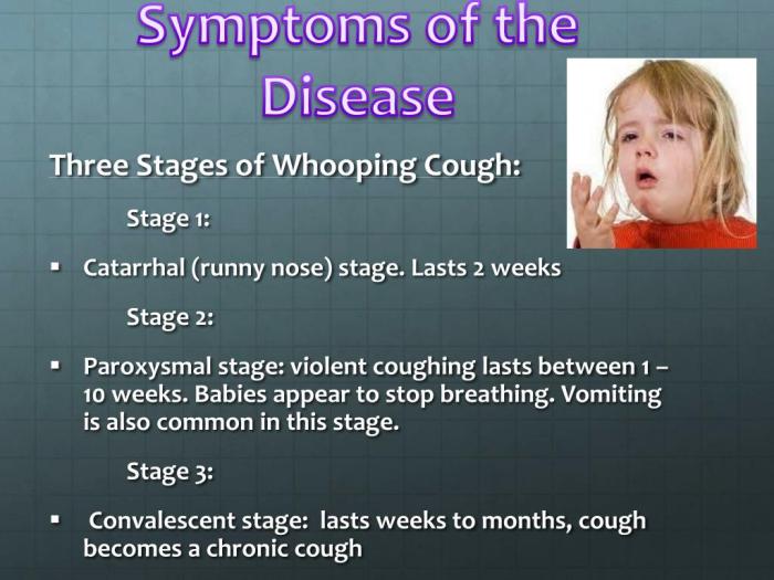 Pertussis epidemiology clinical presentation